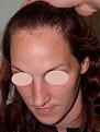 Click image for larger version

Name:	hair-advan-36-obl-l-before.jpg
Views:	458
Size:	86.6 KB
ID:	459515