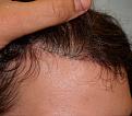 Click image for larger version

Name:	hair-advan-36-top-after.jpg
Views:	377
Size:	27.3 KB
ID:	459520