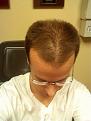 Click image for larger version

Name:	pre-op 11-20-12.jpg
Views:	1206
Size:	33.4 KB
ID:	459539