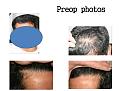 Click image for larger version

Name:	Slide1.JPG
Views:	378
Size:	67.7 KB
ID:	459626