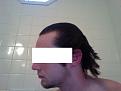 Click image for larger version

Name:	bald1.jpg
Views:	884
Size:	51.5 KB
ID:	459841
