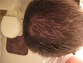 Click image for larger version

Name:	Nov 2010_6 mos Rogaine (5) copy.jpg
Views:	1865
Size:	87.7 KB
ID:	459884