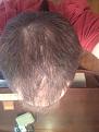 Click image for larger version

Name:	Nov 2012 30 mos Rogaine (2)  copy.jpg
Views:	781
Size:	94.6 KB
ID:	459893