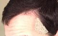 Click image for larger version

Name:	hairline2.JPG
Views:	6564
Size:	72.7 KB
ID:	459951