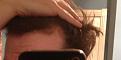 Click image for larger version

Name:	hairline.jpg
Views:	550
Size:	16.2 KB
ID:	459982