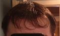 Click image for larger version

Name:	wet hair.jpg
Views:	551
Size:	14.9 KB
ID:	459983