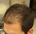 Click image for larger version

Name:	4233_Side_Before.jpg
Views:	527
Size:	43.0 KB
ID:	459996