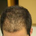 Click image for larger version

Name:	4233_Top_Before.jpg
Views:	529
Size:	34.5 KB
ID:	459997