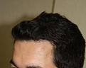Click image for larger version

Name:	4233_Side_After.jpg
Views:	551
Size:	33.2 KB
ID:	459999