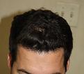 Click image for larger version

Name:	4233_Top_After.jpg
Views:	567
Size:	35.9 KB
ID:	460000