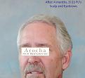 Click image for larger version

Name:	6_After.jpg
Views:	289
Size:	75.3 KB
ID:	460080