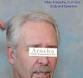 Click image for larger version

Name:	8_After.jpg
Views:	309
Size:	77.5 KB
ID:	460082