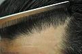 Click image for larger version

Name:	LB_Hairline After.jpg
Views:	754
Size:	95.0 KB
ID:	460119