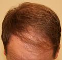 Click image for larger version

Name:	Before-Crown.jpg
Views:	319
Size:	89.9 KB
ID:	460126