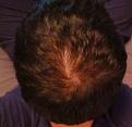 Click image for larger version

Name:	back.jpg
Views:	460
Size:	85.5 KB
ID:	460329