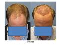 Click image for larger version

Name:	Slide2[1].JPG
Views:	761
Size:	58.2 KB
ID:	460380