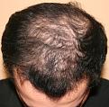 Click image for larger version

Name:	front head top Before 3 (7).jpg
Views:	614
Size:	95.2 KB
ID:	460381