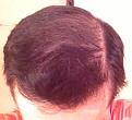 Click image for larger version

Name:	front head top After 3 (1).jpg
Views:	583
Size:	63.1 KB
ID:	460382