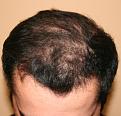 Click image for larger version

Name:	Front - Before.jpg
Views:	585
Size:	92.6 KB
ID:	460383