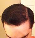 Click image for larger version

Name:	front head top After 3 (2).jpg
Views:	570
Size:	16.5 KB
ID:	460384