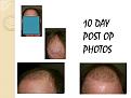Click image for larger version

Name:	Slide2.JPG
Views:	334
Size:	55.0 KB
ID:	460390