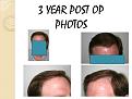 Click image for larger version

Name:	Slide3.JPG
Views:	366
Size:	61.7 KB
ID:	460391