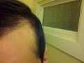 Click image for larger version

Name:	Bald2.jpg
Views:	416
Size:	47.2 KB
ID:	460412
