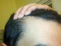 Click image for larger version

Name:	Bald3.jpg
Views:	410
Size:	30.4 KB
ID:	460413