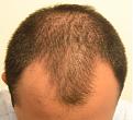 Click image for larger version

Name:	hairnow.jpg
Views:	599
Size:	79.8 KB
ID:	460449