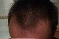 Click image for larger version

Name:	head11.jpg
Views:	492
Size:	15.0 KB
ID:	460456