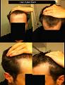 Click image for larger version

Name:	pulled.jpg
Views:	869
Size:	86.3 KB
ID:	460536