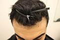Click image for larger version

Name:	hairline1.jpg
Views:	1543
Size:	5.0 KB
ID:	462201