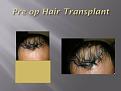 Click image for larger version

Name:	Slide2.jpg
Views:	741
Size:	41.3 KB
ID:	462366