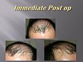 Click image for larger version

Name:	Slide3.jpg
Views:	616
Size:	55.4 KB
ID:	462367