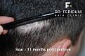 Click image for larger version

Name:	F8.jpg
Views:	561
Size:	96.5 KB
ID:	462380