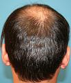 Click image for larger version

Name:	Crown - before.jpg
Views:	326
Size:	95.4 KB
ID:	462397