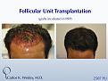 Click image for larger version

Name:	Slide3.jpg
Views:	665
Size:	72.1 KB
ID:	462434