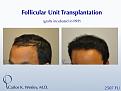 Click image for larger version

Name:	Slide5.jpg
Views:	800
Size:	61.8 KB
ID:	462436