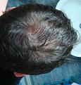 Click image for larger version

Name:	top back wet.jpg
Views:	1016
Size:	67.8 KB
ID:	462494