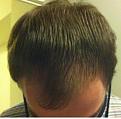 Click image for larger version

Name:	pre_treatments1.jpg
Views:	1494
Size:	100.2 KB
ID:	462499