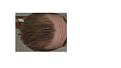 Click image for larger version

Name:	hairline.jpg
Views:	499
Size:	29.6 KB
ID:	462740