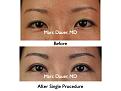 Click image for larger version

Name:	Hair Transplant Slides.002.jpg
Views:	599
Size:	63.6 KB
ID:	462768