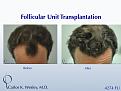 Click image for larger version

Name:	Slide6.jpg
Views:	682
Size:	70.9 KB
ID:	462834