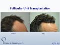 Click image for larger version

Name:	Slide7.jpg
Views:	624
Size:	70.7 KB
ID:	462835