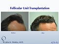 Click image for larger version

Name:	Slide8.jpg
Views:	609
Size:	66.5 KB
ID:	462836