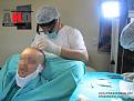Click image for larger version

Name:	9-From beard donor area to vertexx.jpg
Views:	634
Size:	87.4 KB
ID:	462903