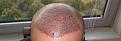 Click image for larger version

Name:	20-3530 grafts 2nd day.jpg
Views:	569
Size:	46.0 KB
ID:	462913
