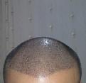Click image for larger version

Name:	22-8th day...jpg
Views:	637
Size:	53.8 KB
ID:	462915