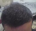 Click image for larger version

Name:	35-5 months 5 days.jpg
Views:	717
Size:	81.1 KB
ID:	462930