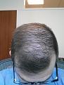 Click image for larger version

Name:	20130716_150123.jpg
Views:	555
Size:	87.6 KB
ID:	463009